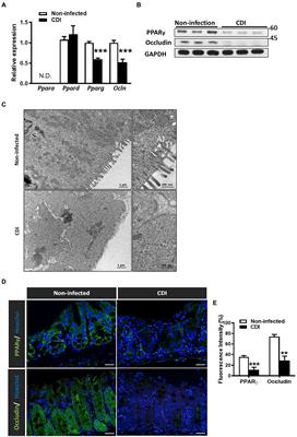 Peroxisome proliferator-activated receptor-γ as the gatekeeper of tight junction in Clostridioides difficile infection